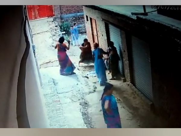 Agra lady teacher brutally beaten by molestation accused BJp leaders family Agra lady teacher brutally beaten by molestation accused BJp leaders family