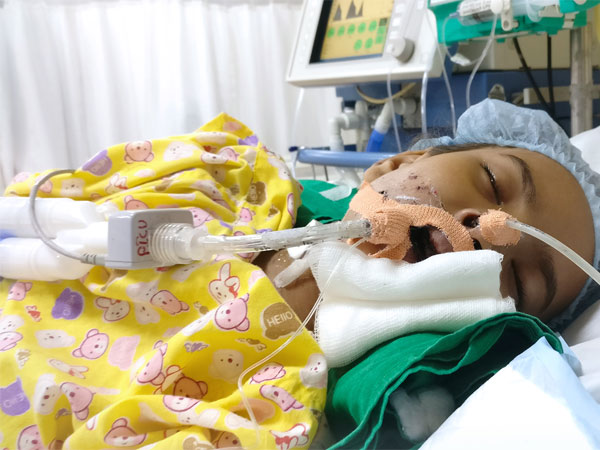 girl, Vishaka, girl Fighting Multiple Organ Failure girl, Vishaka, girl Fighting Multiple Organ Failure