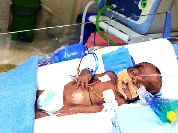 बेटी को सांस लेने में दिक्कत.... मां-बाप परेशान