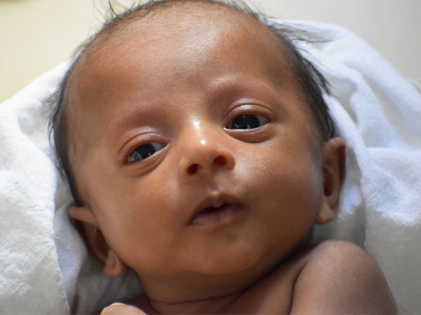 baby, save a life, treatment, help, surgery, doctor baby, save a life, treatment, help, surgery, doctor