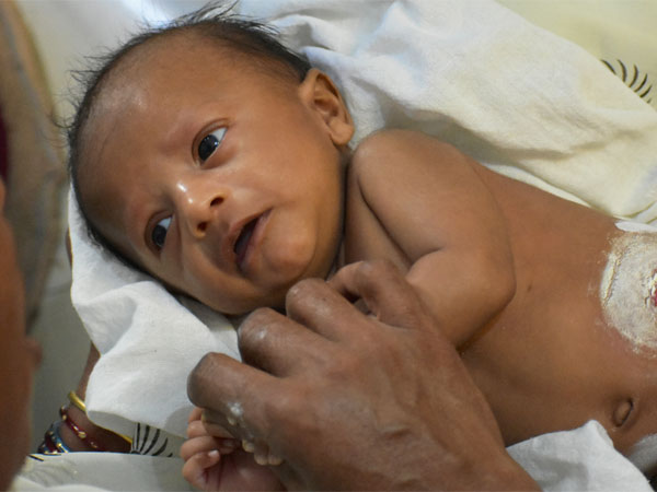 baby, save a life, treatment, help, surgery, doctor baby, save a life, treatment, help, surgery, doctor