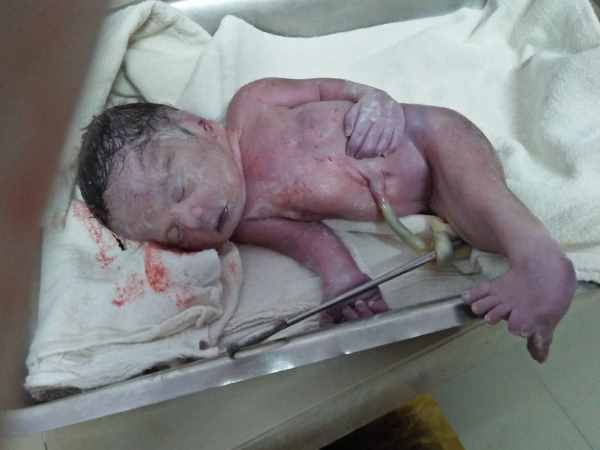 siren takes birth in Saharanpur hospital siren takes birth in Saharanpur hospital