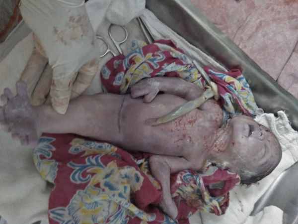 siren takes birth in Saharanpur hospital siren takes birth in Saharanpur hospital