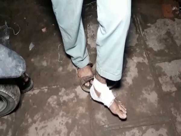 donkey killed for biting people in varanasi donkey killed for biting people in varanasi
