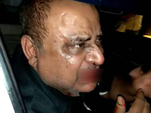 इतना मारा कि मुंह खून से लाल-लाल हो गया