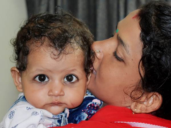 11 महीने की शिवानी की सर्जरी के लिए नहीं है मां-बाप के पास पैसे 11 महीने की शिवानी की सर्जरी के लिए नहीं है मां-बाप के पास पैसे
