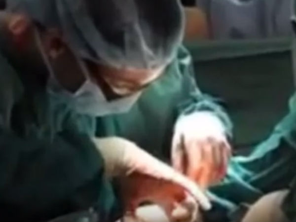 10 साल से खा रहा कीलें