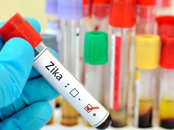 US Health Alert on Zika: Having a Baby, Do not Visit Rajasthan US Health Alert on Zika: Having a Baby, Do not Visit Rajasthan