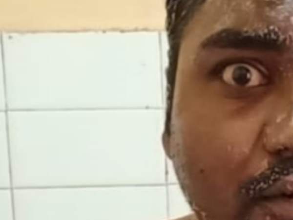 man poured hot oil on shop keeper in sultanpur man poured hot oil on shop keeper in sultanpur
