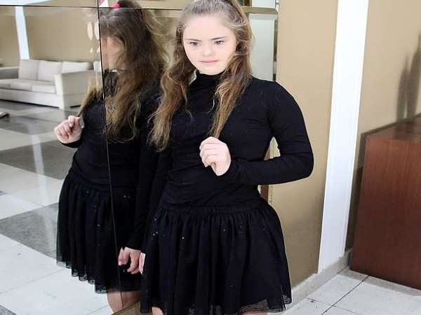 A 14-year-old model with Downs syndrome is taking the internet by storm after an Instagram post A 14-year-old model with Downs syndrome is taking the internet by storm after an Instagram post