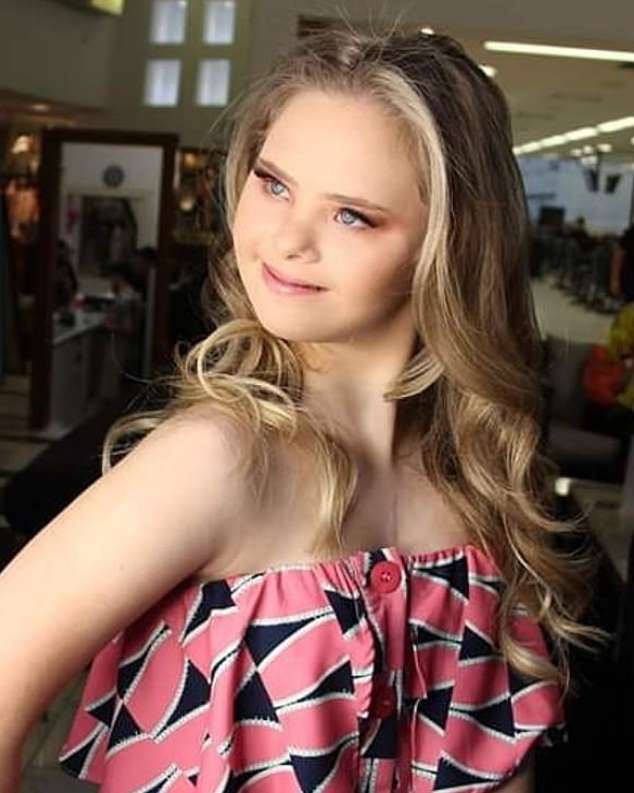 A 14-year-old model with Downs syndrome is taking the internet by storm after an Instagram post A 14-year-old model with Downs syndrome is taking the internet by storm after an Instagram post