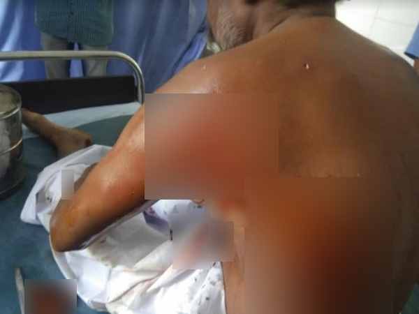 PHOTOS: lion attack on man in village of rajkot PHOTOS: lion attack on man in village of rajkot