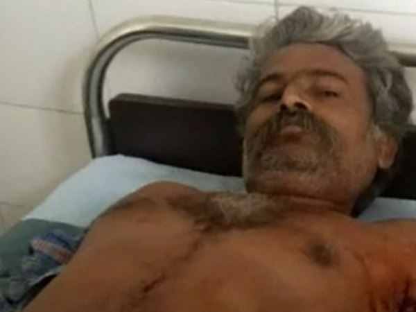 PHOTOS: lion attack on man in village of rajkot PHOTOS: lion attack on man in village of rajkot