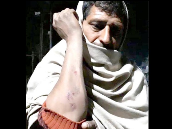 Communal Clash at Saharanpur, Many people injured including women Communal Clash at Saharanpur, Many people injured including women