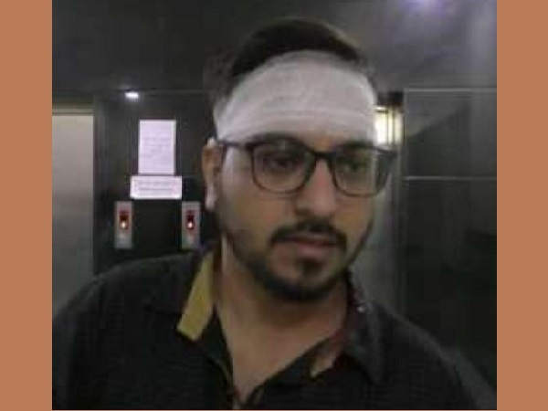 Madhya Pradesh: BJP Leader jitendra soni Attacked, Robbed Of Gold Ornaments Madhya Pradesh: BJP Leader jitendra soni Attacked, Robbed Of Gold Ornaments