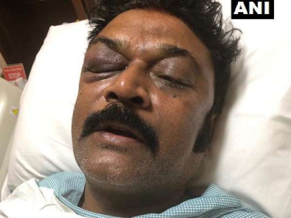 अस्पताल में भर्ती हैं आनंद सिंह