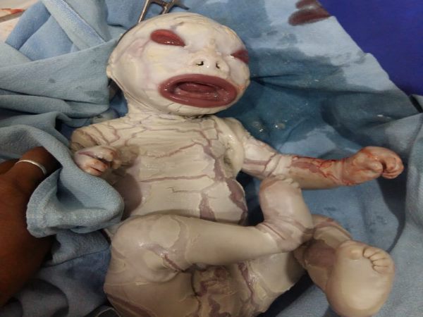 ALWAR WOMAN GAVE BIRTH TO STRANGE CHILD ALWAR WOMAN GAVE BIRTH TO STRANGE CHILD
