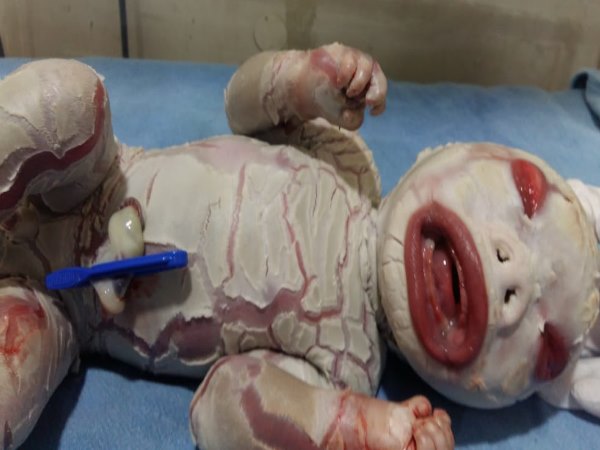 ALWAR WOMAN GAVE BIRTH TO STRANGE CHILD ALWAR WOMAN GAVE BIRTH TO STRANGE CHILD