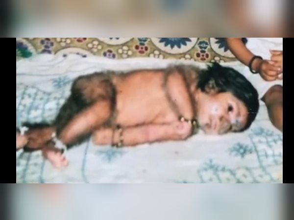 विदेशी डॉक्टरों की मदद से करवाएंगे इलाज