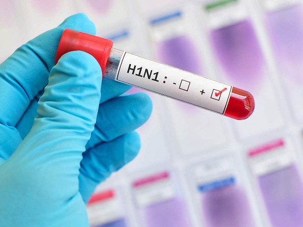 Swine flu claims 88 deaths in past 55 days in Gujarat Swine flu claims 88 deaths in past 55 days in Gujarat