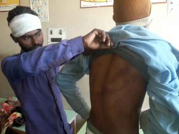 Dabangas brutally beaten the Dalit people Dabangas brutally beaten the Dalit people