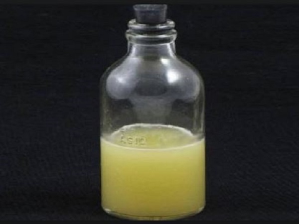 noida: woman allegedly gave a bottle of acid to a labourer who took a few sips noida: woman allegedly gave a bottle of acid to a labourer who took a few sips