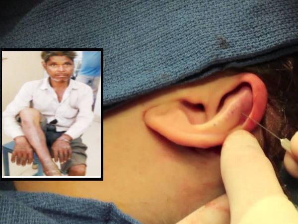 Jhalawar patient Ear Operation instead of knee in Bhamashah Yojana Jhalawar patient Ear Operation instead of knee in Bhamashah Yojana