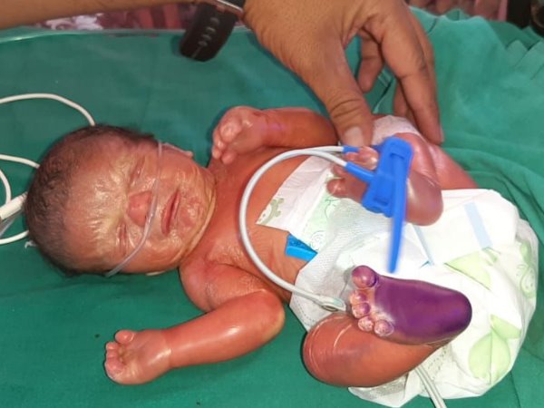 plastic baby Born in Nagaur Rajasthan plastic baby Born in Nagaur Rajasthan