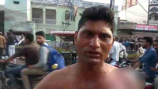 samosa shopkeeper poured hot oil on man for one rupee samosa shopkeeper poured hot oil on man for one rupee
