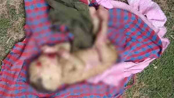 doctor shocked after seeing this unique infant doctor shocked after seeing this unique infant