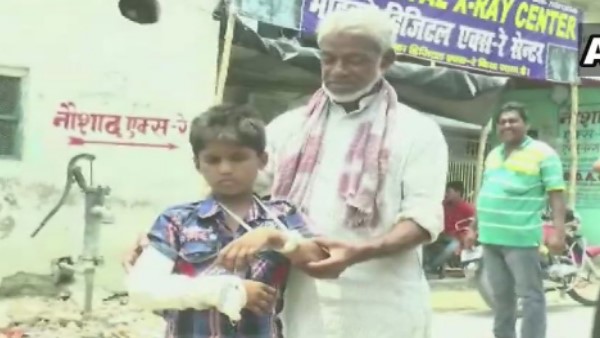 दाएं की जगह बांए हाथ में लगाया प्लास्टर