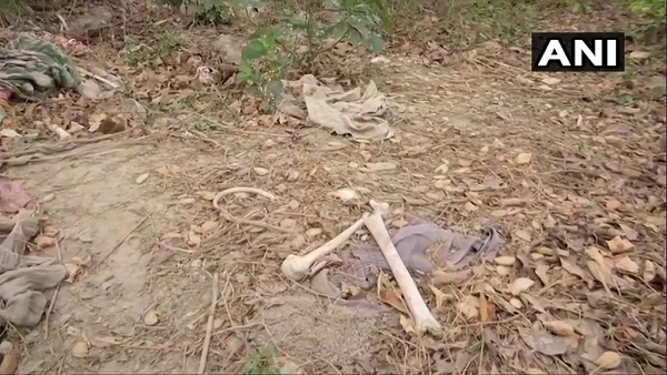 Muzaffarpur: Bihar Health Dept orders investigation after human skeletal remains found behind SKMCH Muzaffarpur: Bihar Health Dept orders investigation after human skeletal remains found behind SKMCH