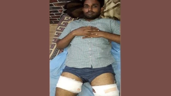 notorious criminal shot by special cell of Delhi Police in an encounter near Akshardham notorious criminal shot by special cell of Delhi Police in an encounter near Akshardham