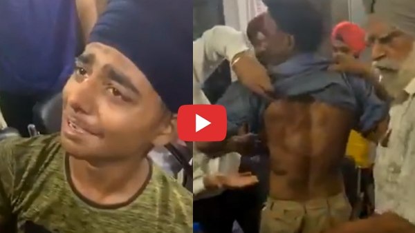 नए वीडियो में दिखे टैंपो ड्राइवर के घाव