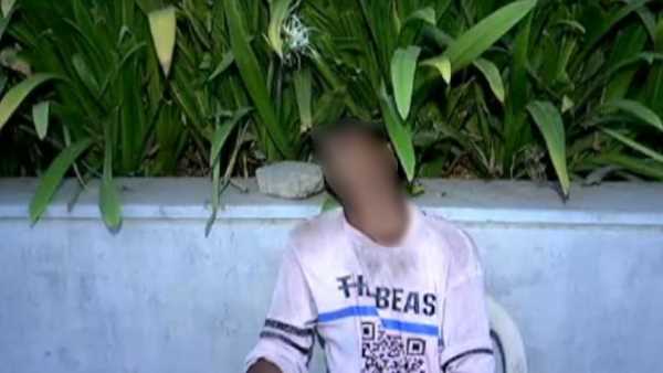 पैर में फ्रैक्चर हो गया, शरीर पर काले चकत्ते पड़ गए