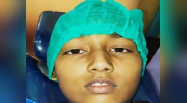 14 year old girl have 50 teech in her Mouth in Kota 14 year old girl have 50 teech in her Mouth in Kota