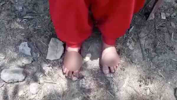 after meeting with boyfriend, father beats her brutally after meeting with boyfriend, father beats her brutally