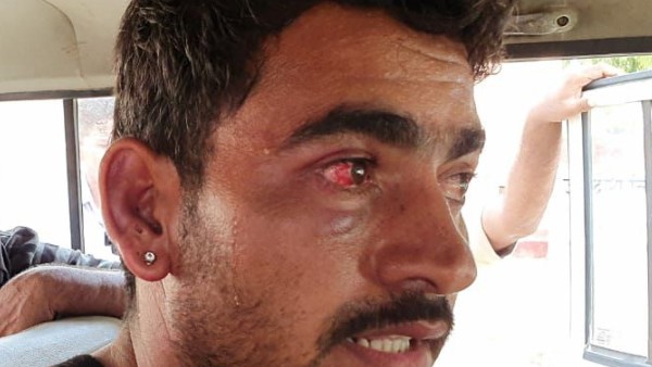 3 people, brutally beaten By Barmer Police 3 people, brutally beaten By Barmer Police