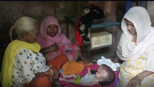 Bizarre child born in Dausa Rajasthan, weirdly growing head after birth Bizarre child born in Dausa Rajasthan, weirdly growing head after birth