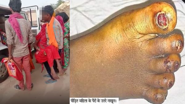 Churu woman charged on Police for brutally beaten Churu woman charged on Police for brutally beaten