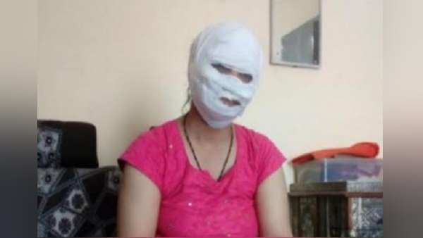 ex Husband acid attack on woman ex Husband acid attack on woman