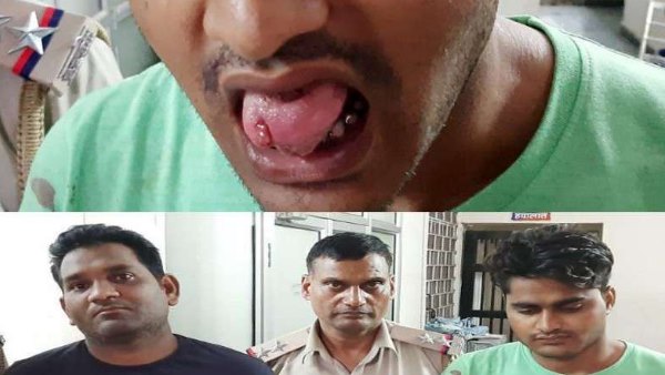 21 year old girl Chopped tong of young man for molestation in Ola Cab in jaipur 21 year old girl Chopped tong of young man for molestation in Ola Cab in jaipur