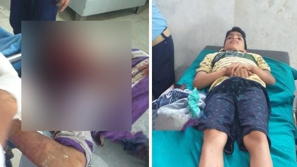 Two individuals were injured, today, in a blast at Adigam Devsar area of district Kulgam Two individuals were injured, today, in a blast at Adigam Devsar area of district Kulgam