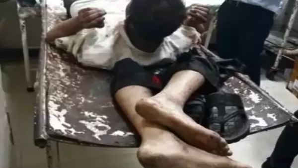 man severed legs kept near head in hospital in faridabad man severed legs kept near head in hospital in faridabad