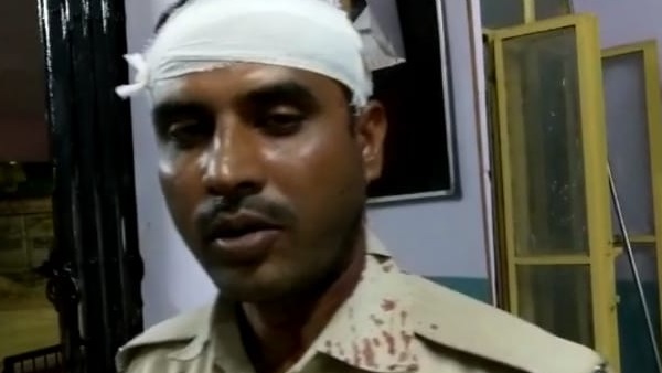 घायल पुलिसकर्मी की जुबानी