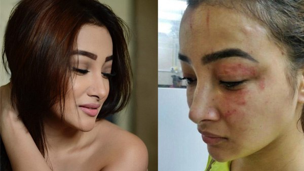 प्राइवेसी पर फर्क नहीं पड़ता तो मैं राजी हो गई