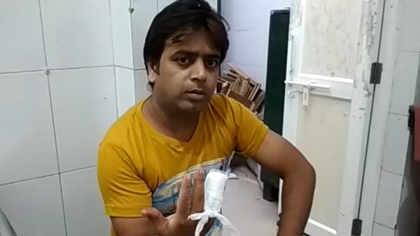 man chewed off friend finger over minor dispute in moradabad man chewed off friend finger over minor dispute in moradabad