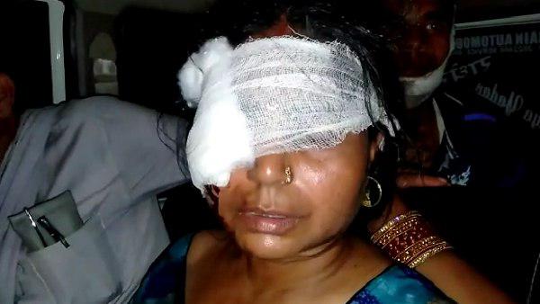 younger brother brutally attacked his elder brother and family younger brother brutally attacked his elder brother and family