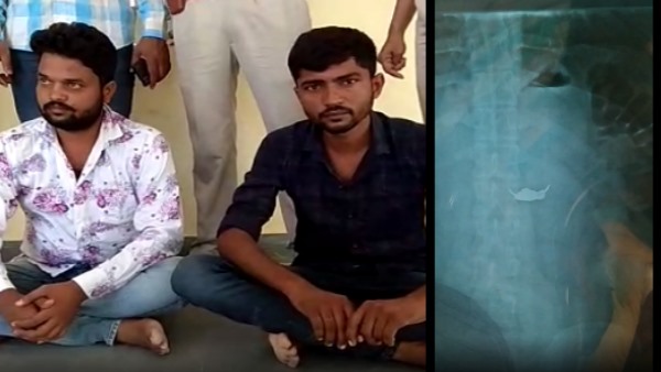 Thief swallowed gold chain after seeing gangashahar police Bikaner Thief swallowed gold chain after seeing gangashahar police Bikaner
