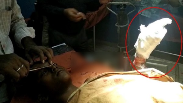 13 year old boy injured as mobile blast on hand 13 year old boy injured as mobile blast on hand